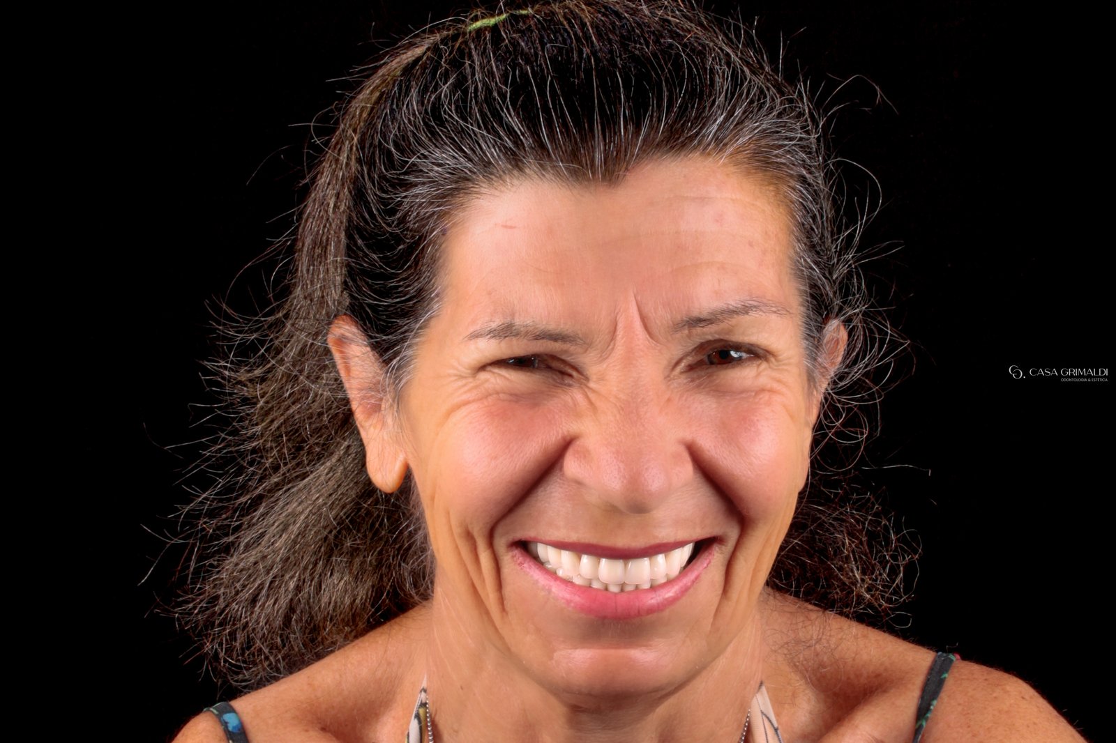 Paciente da Casa Grimaldi sorrindo com prótese dentária — resultado natural em Itapema